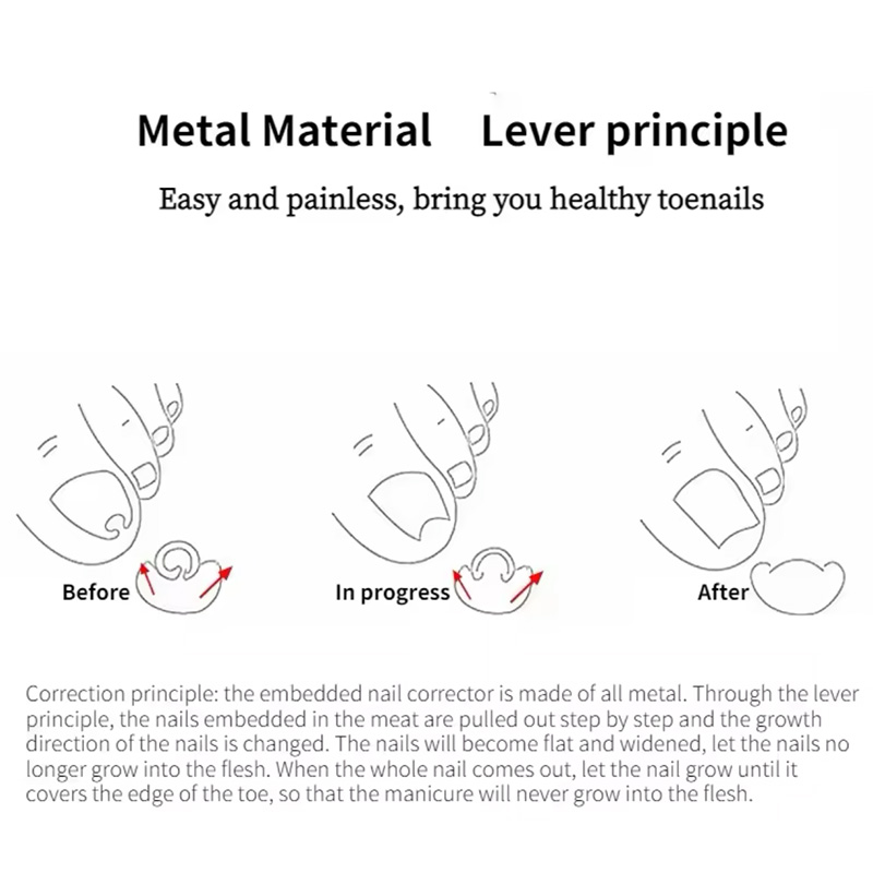 دستگاه اصلاح فرم و ارتودنسی ناخن مدل Nails